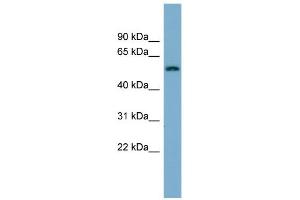 WB Suggested Anti-MFRP Antibody Titration:  0. (MFRP antibody  (N-Term))