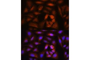 Immunofluorescence analysis of U2OS cells using NCAPH Rabbit pAb (ABIN1680979, ABIN3019036, ABIN3019037 and ABIN6220682) at dilution of 1:100. (NCAPH antibody  (AA 1-250))