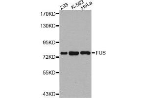 Western Blotting (WB) image for anti-Fused in Sarcoma (FUS) antibody (ABIN1876950) (FUS antibody)