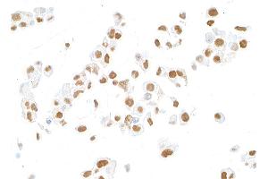 Immunocytochemistry (ICC) image for anti-MutL Homolog 1 (MLH1) (AA 450-500) antibody (ABIN7455102) (Recombinant MLH1 antibody  (AA 450-500))