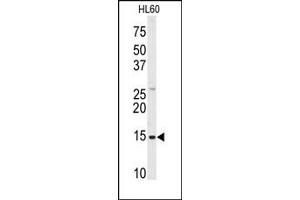 Image no. 1 for anti-SnRNP-D1 / Sm-D (Middle Region) antibody (ABIN358018)