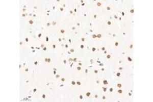 Immunohistochemistry analysis of paraffin-embedded mouse brain using,PQBP1 (ABIN7075126) at dilution of 1: 6000 (PQBP1 antibody)