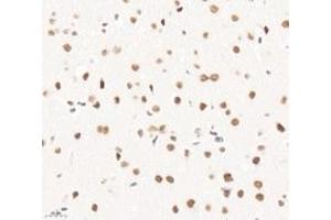 Immunohistochemistry analysis of paraffin-embedded mouse brain using,PQBP1 (ABIN7075126) at dilution of 1: 6000
