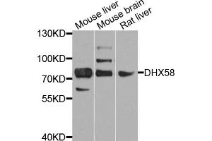 Western blot analysis of extracts of various cell lines, using DHX58 antibody (ABIN5974537) at 1/1000 dilution. (DHX58 antibody)