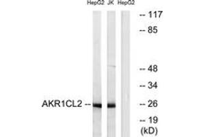 Western blot analysis of extracts from HepG2/Jurkat cells, using AKR1CL2 Antibody. (AKR1E2 antibody  (AA 141-190))