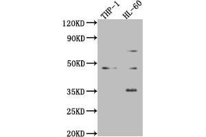 Western Blot Positive WB detected in: Mouse heart tissue, Mouse spleen tissue, Mouse lung tissue All lanes: ZKSCAN3 antibody at 4 μg/mL Secondary Goat polyclonal to rabbit IgG at 1/50000 dilution predicted band size: 61, 44 kDa observed band size: 61, 44 kDa (ZKSCAN3 antibody  (AA 8-275))