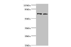 Western blot All lanes: Annexin A6 antibody at 4 μg/mL Lane 1: Jurkat whole cell lysate Lane 2: Hela whole cell lysate Secondary Goat polyclonal to rabbit IgG at 1/10000 dilution Predicted band size: 76, 73 kDa Observed band size: 76 kDa (ANXA6 antibody  (AA 1-250))