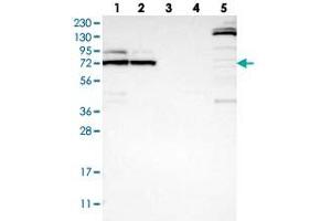 Western blot analysis of Lane 1: RT-4, Lane 2: U-251 MG, Lane 3: Human Plasma, Lane 4: Liver, Lane 5: Tonsil with METTL16 polyclonal antibody  at 1:250-1:500 dilution. (METTL16 antibody)