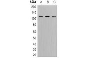 Western blot analysis of GLUR6 expression in SW620 (A), A549 (B), mouse brain (C) whole cell lysates.