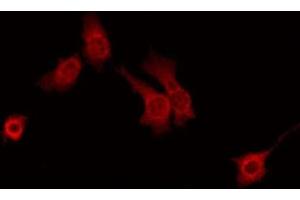 ABIN6275282 staining HT29 by IF/ICC. (PTGR1 antibody  (Internal Region))