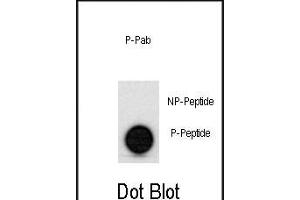 Dot blot analysis of anti-hp53- Phospho-specific Pab (ABIN389620 and ABIN2839624) on nitrocellulose membrane.