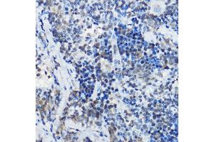 Immunohistochemistry of paraffin-embedded rat spleen using MYBBP1A Rabbit pAb (ABIN1680938, ABIN3018915, ABIN3018916 and ABIN6220628) at dilution of 1:100 (40x lens). (MYBBP1A antibody  (AA 1104-1328))