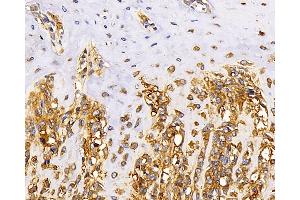 Immunohistochemistry analysis of paraffin-embedded rat bone using MAGEC1 Polyclonal Antibody at dilution of 1:300. (MAGEC1 antibody)