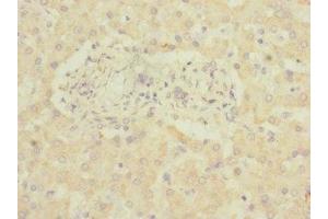 Immunohistochemistry of paraffin-embedded human liver tissue using ABIN7143403 at dilution of 1:100 (Adhesion G-Protein Coupled Receptor G6 (ADGRG6) (AA 40-300) antibody)