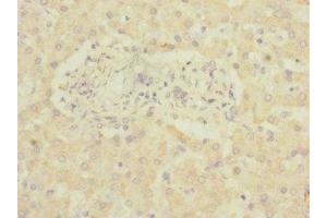 Immunohistochemistry of paraffin-embedded human liver tissue using ABIN7143403 at dilution of 1:100