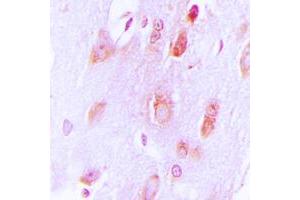 Immunohistochemical analysis of Tyrosine Hydroxylase staining in human brain formalin fixed paraffin embedded tissue section.