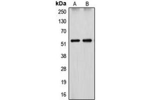 Western blot analysis of Cytochrome P450 26A1 expression in HepG2 (A), HEK293T (B) whole cell lysates. (CYP26A1 antibody  (Center))