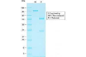 SDS-PAGE Analysis Purified EpCAM Rabbit Recombinant Monoclonal Antibody (EGP40/1556R). (Recombinant EpCAM antibody)