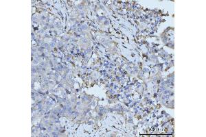 IHC analysis of PLD3 using anti-PLD3 antibody (ABIN7599439). (PLD3 antibody  (AA 1-490))