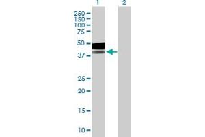 Western Blot analysis of PLA2G15 expression in transfected 293T cell line by PLA2G15 MaxPab polyclonal antibody. (PLA2G15 antibody  (AA 1-412))