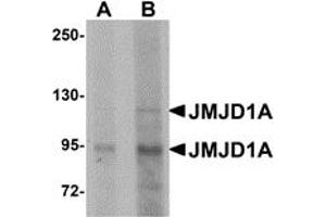 Western Blotting (WB) image for anti-Lysine (K)-Specific Demethylase 3A (KDM3A) (N-Term) antibody (ABIN1031423) (KDM3A antibody  (N-Term))