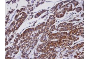 IHC-P Image Immunohistochemical analysis of paraffin-embedded A549 xenograft, using ORP1, antibody at 1:100 dilution.