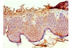 Immunohistochemistry of paraffin-embedded human skin tissue using ABIN7167500 at dilution of 1:100 (PTPRA antibody  (AA 20-142))