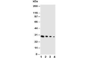 Western blot testing of GDNF antibody and Lane 1:  recombinant human protein 10ng;  2: 5ng;  3: 2.
