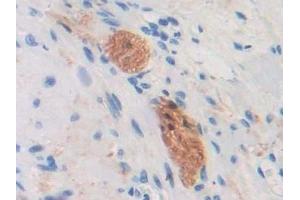 Detection of CD299 in Human Prostate Tissue using Polyclonal Antibody to Cluster Of differentiation 299 (CD299)