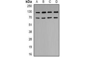 Western blot analysis of K Cadherin expression in BT474 (A), A549 (B), SHSY5Y (C), HEK293T (D) whole cell lysates. (CDH6 antibody)