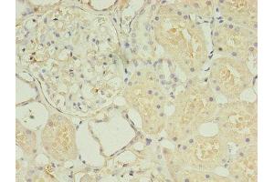 Immunohistochemistry of paraffin-embedded human kidney tissue using ABIN7155725 at dilution of 1:100 (HOXA6 antibody  (AA 1-233))