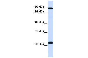 RGS19 antibody used at 1 ug/ml to detect target protein. (RGS19 antibody  (N-Term))