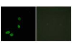 Immunofluorescence analysis of HeLa cells, using HMG17 antibody. (HMGN2 antibody)