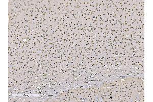 IHC analysis of KHSRP using anti-KHSRP antibody (ABIN7599776).