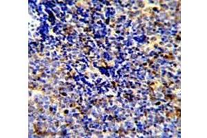 IHC analysis of FFPE human lymphoma stained with MERTK antibody