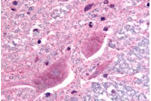 SCN3A antibody  (C-Term)