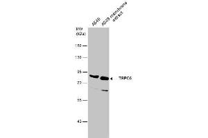 WB Image A549 whole cell and membrane extracts (30 μg) were separated by 7. (TRPC6 antibody  (C-Term))