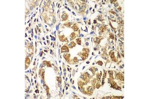 Immunohistochemistry of paraffin-embedded human gastric using RAC1 antibody. (RAC1 antibody  (AA 1-192))