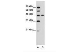 Image no. 2 for anti-HSPB (Heat Shock 27kDa) Associated Protein 1 (HSPBAP1) (AA 412-461) antibody (ABIN6736308) (HSPBAP1 antibody  (AA 412-461))