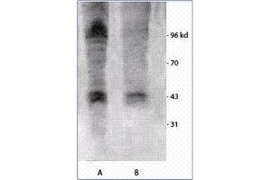 Image no. 1 for anti-Phosphothreonine antibody (ABIN264877) (Phosphothreonine antibody)