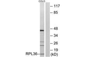 Western blot analysis of extracts from COLO cells, using RPL36 Antibody. (RPL36 antibody  (AA 51-100))