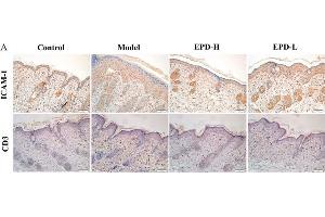 Immunohistochemistry (Paraffin-embedded Sections) (IHC (p)) image for anti-Intercellular Adhesion Molecule 1 (ICAM1) (AA 201-300) antibody (ABIN670806)