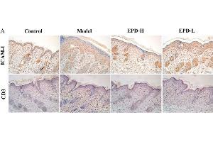 EPD inhibited inflammatory cell infiltration in IMQ-induced psoriasis-like mouse mode. (ICAM1 antibody  (AA 201-300))
