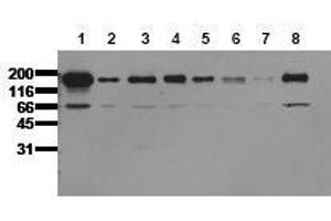 Western Blotting (WB) image for anti-Epidermal Growth Factor Receptor (EGFR) (C-Term) antibody (ABIN126786) (EGFR antibody  (C-Term))