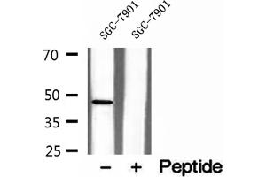 Western blot analysis of extracts of SGC-7901 cells, using NOB1 antibody.