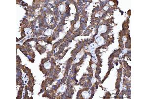 IHC analysis of FRY using anti-FRY antibody (ABIN7599716). (FRY antibody  (AA 11-3013))
