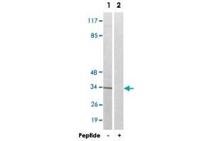 Western blot analysis of extracts from Jurkat cells, using AQP12A polyclonal antibody .