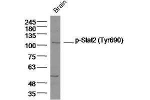 Mouse brain lysates probed with Stat2 (Tyr690) Polyclonal Antibody, unconjugated  at 1:300 overnight at 4°C followed by a conjugated secondary antibody for 60 minutes at 37°C. (STAT2 antibody  (pTyr690))