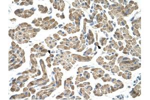 NEU1 antibody was used for immunohistochemistry at a concentration of 4-8 ug/ml to stain Skeletal muscle cells (arrows) in Human Muscle. (NEU1 antibody)