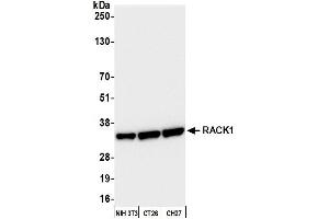 anti-Guanine Nucleotide Binding Protein (G Protein), beta Polypeptide 2-Like 1 (GNB2L1) (AA 1-50) antibody